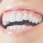 healthy-teeth-and-gums