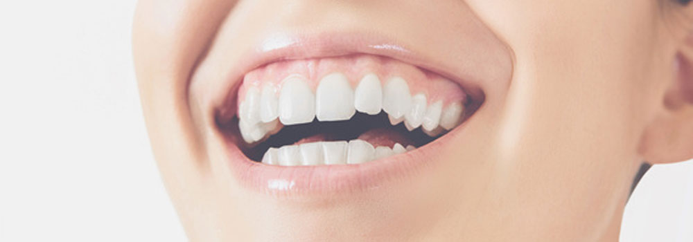 healthy-teeth-and-gums